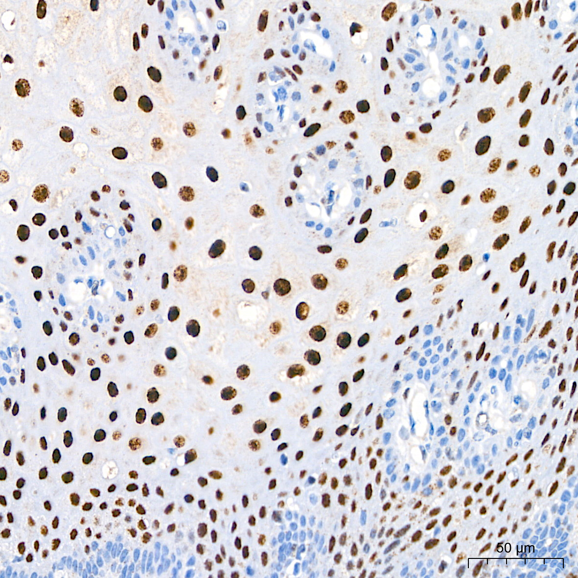 SQSTM1/p62 Rabbit mAb