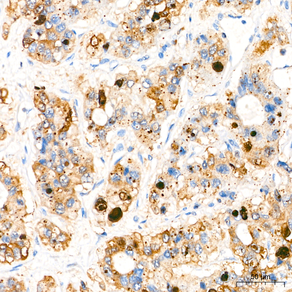 SQSTM1/p62 Rabbit mAb