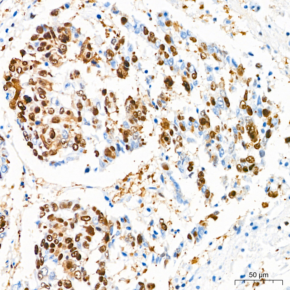 SQSTM1/p62 Rabbit mAb