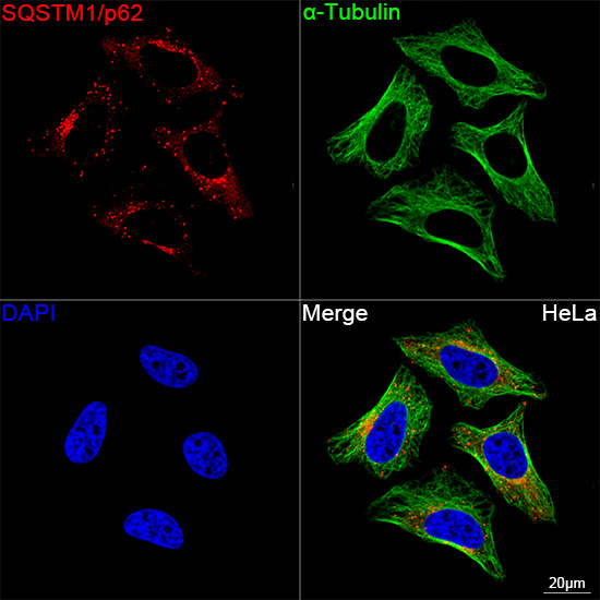 SQSTM1/p62 Rabbit mAb