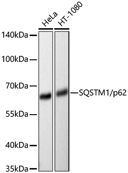 SQSTM1/p62 Rabbit mAb
