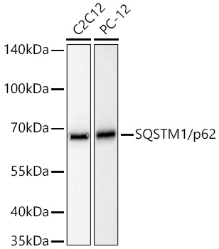 SQSTM1/p62 Rabbit mAb