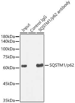 SQSTM1/p62 Rabbit mAb