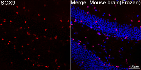 SOX9 Rabbit mAb