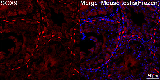 SOX9 Rabbit mAb