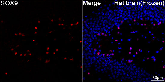 SOX9 Rabbit mAb