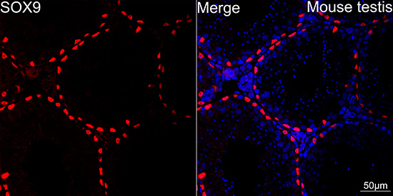 SOX9 Rabbit mAb
