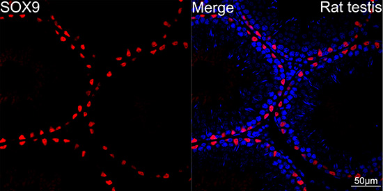 SOX9 Rabbit mAb