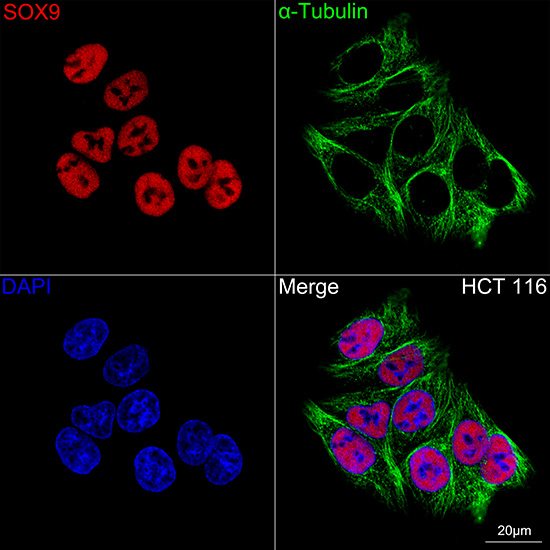 SOX9 Rabbit mAb
