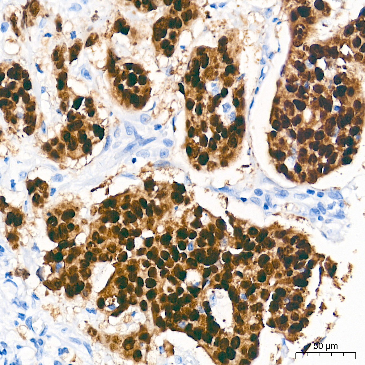 SOX9 Rabbit mAb