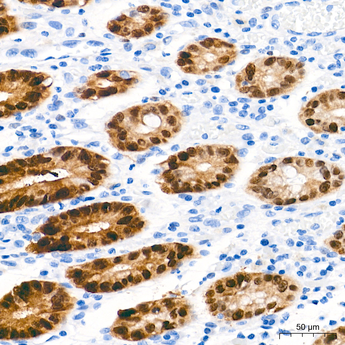 SOX9 Rabbit mAb