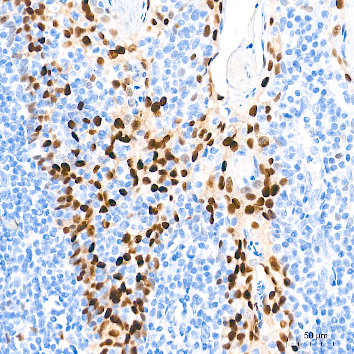 SOX9 Rabbit mAb