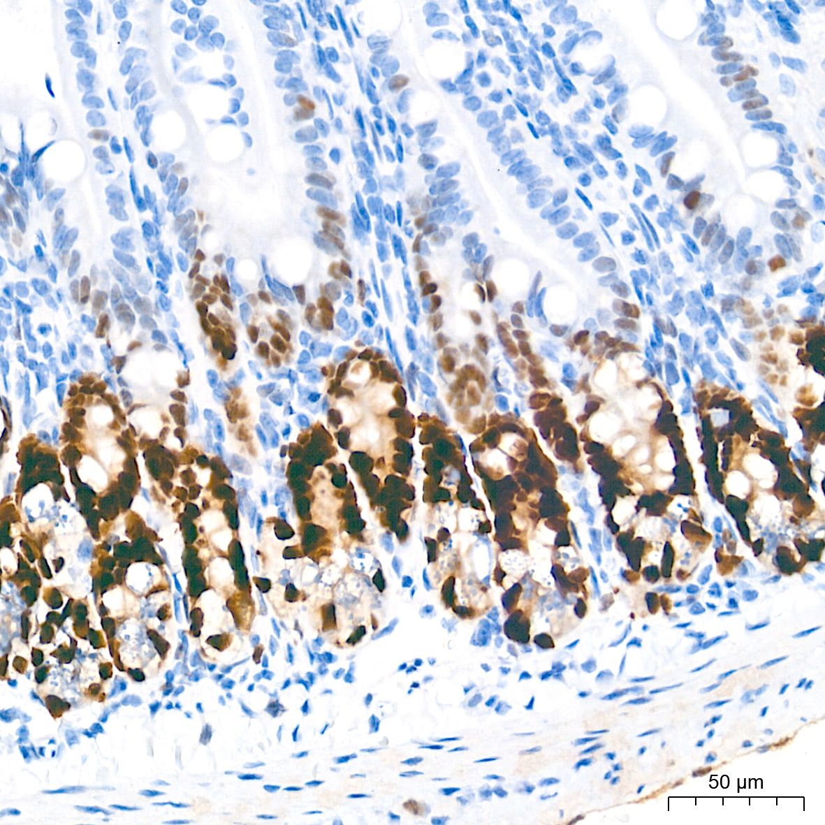SOX9 Rabbit mAb