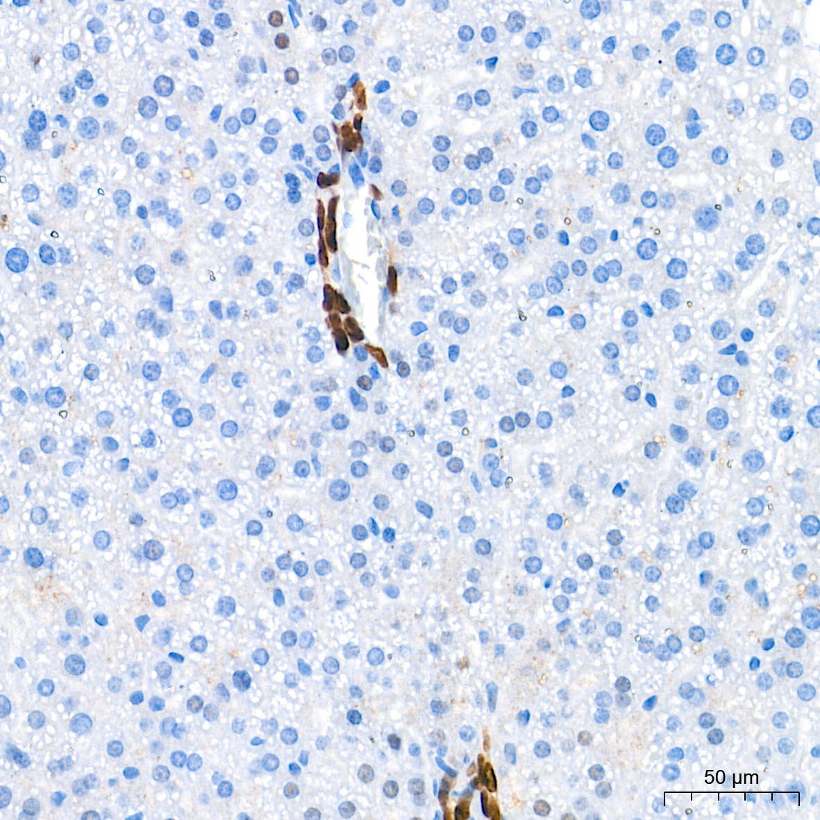 SOX9 Rabbit mAb