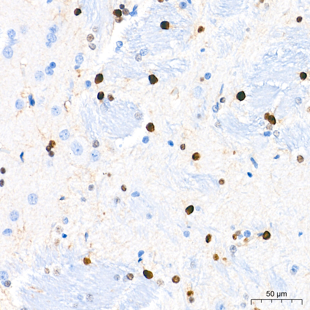 SOX9 Rabbit mAb
