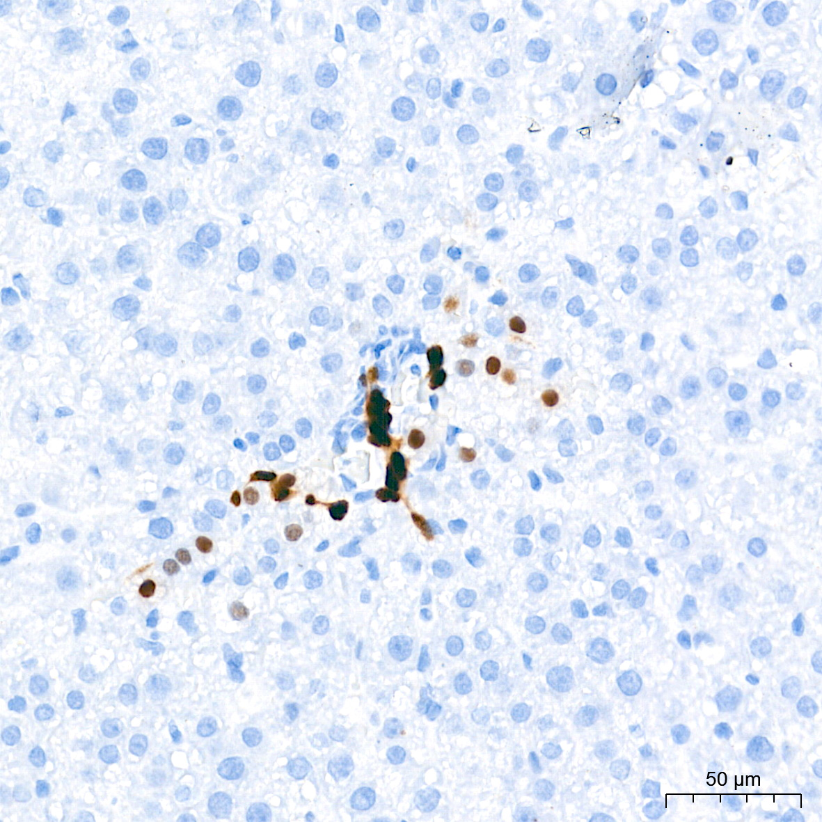SOX9 Rabbit mAb