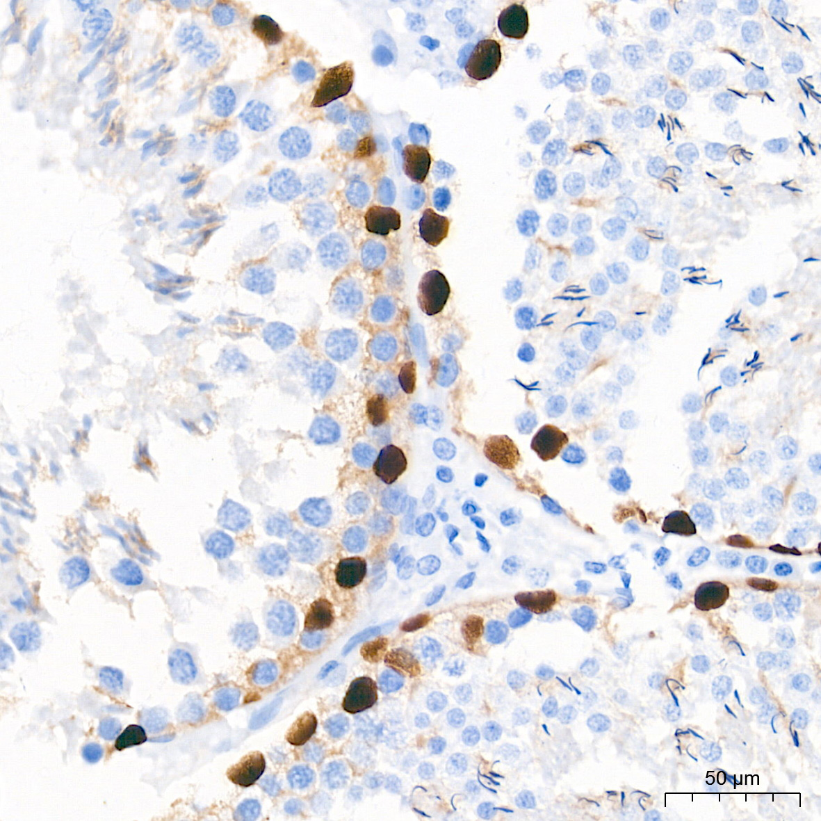 SOX9 Rabbit mAb