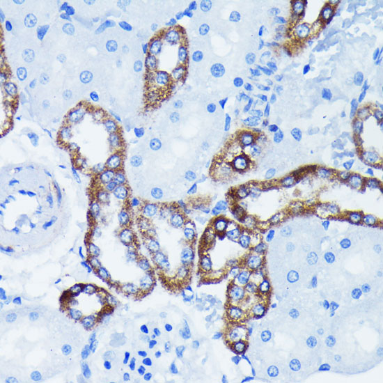 IκBα Rabbit mAb