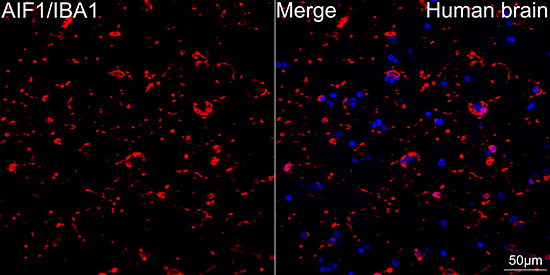 AIF1/IBA1 Rabbit mAb