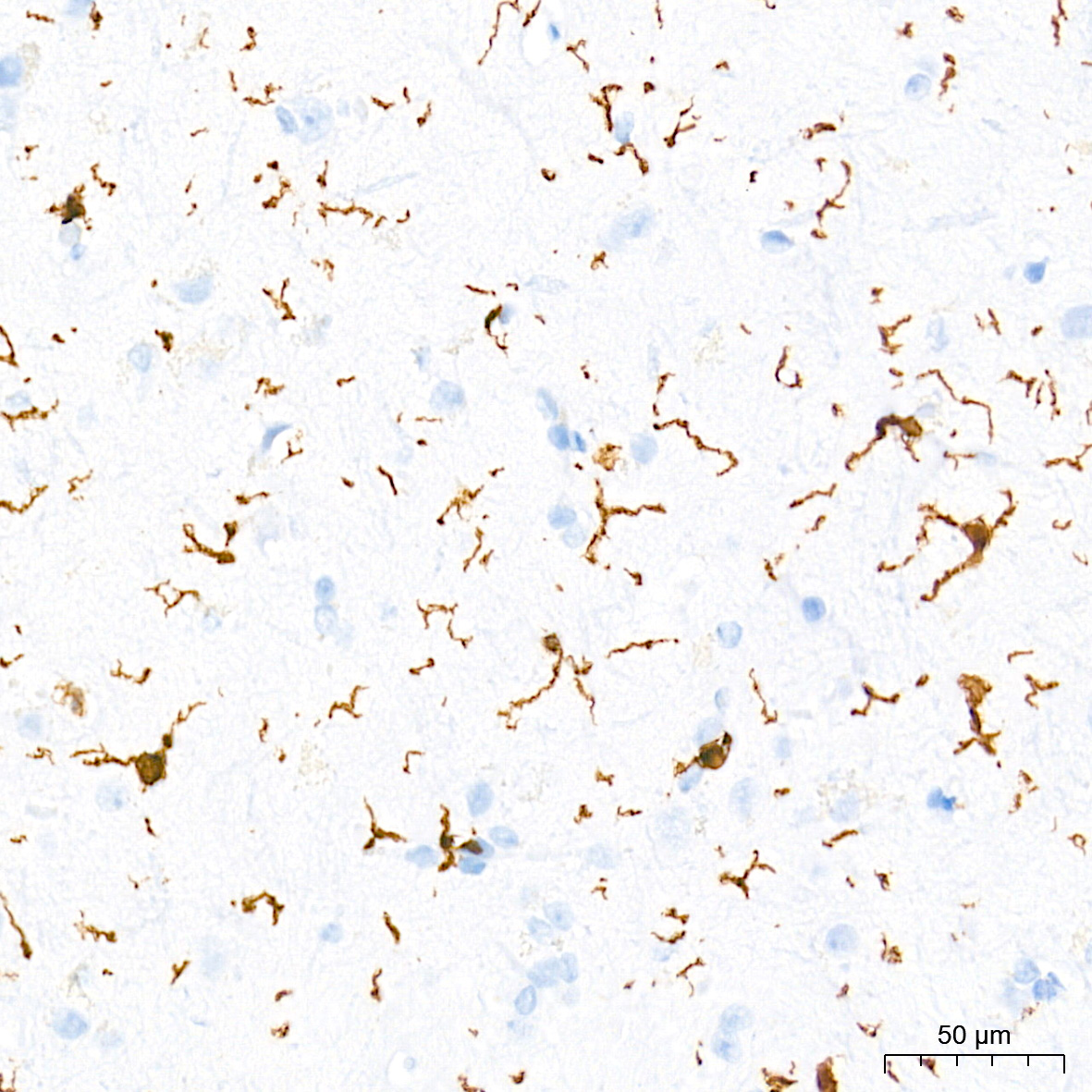 AIF1/IBA1 Rabbit mAb