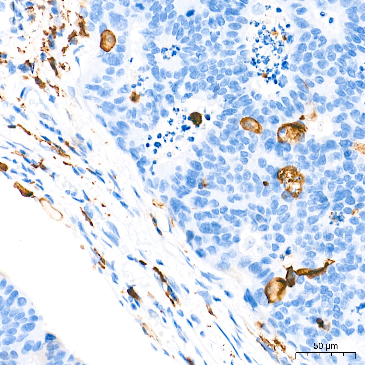 AIF1/IBA1 Rabbit mAb