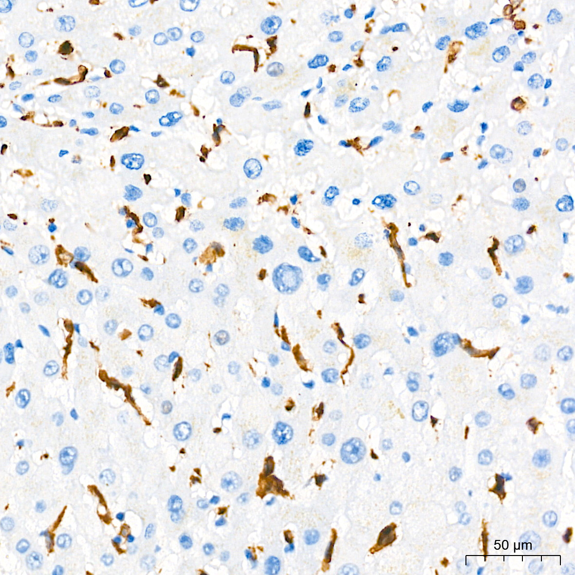 AIF1/IBA1 Rabbit mAb