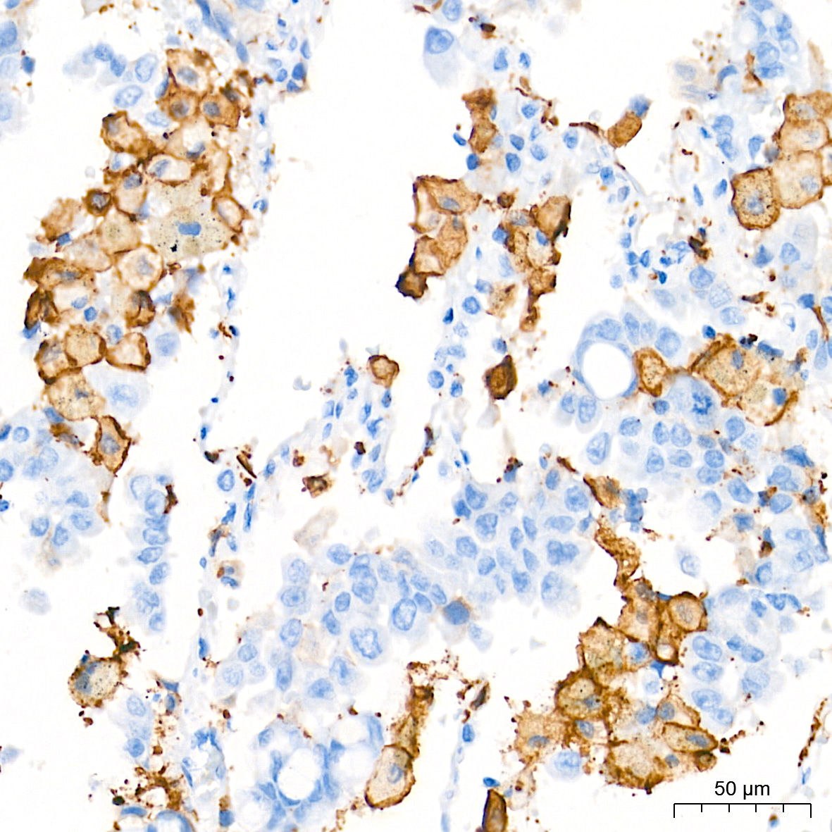 AIF1/IBA1 Rabbit mAb