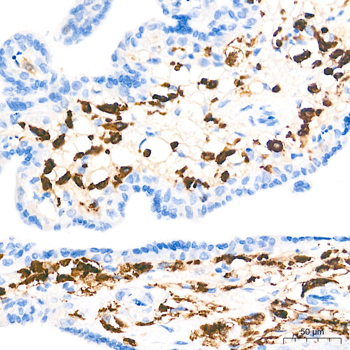 AIF1/IBA1 Rabbit mAb