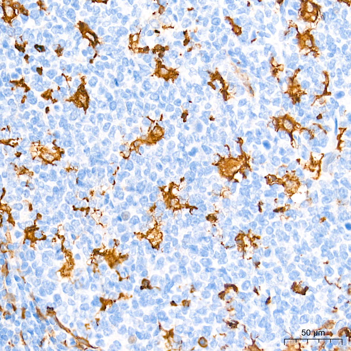 AIF1/IBA1 Rabbit mAb