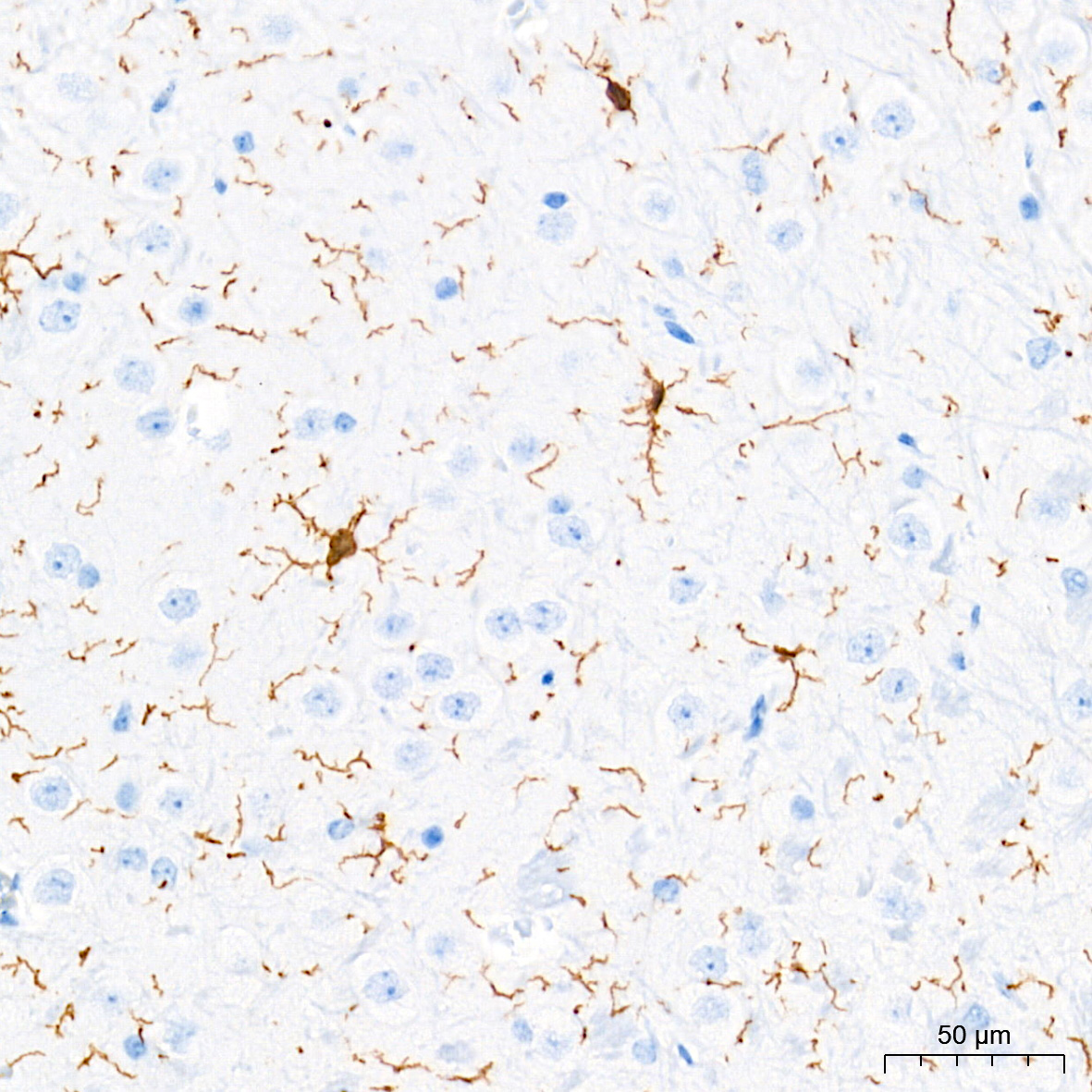 AIF1/IBA1 Rabbit mAb