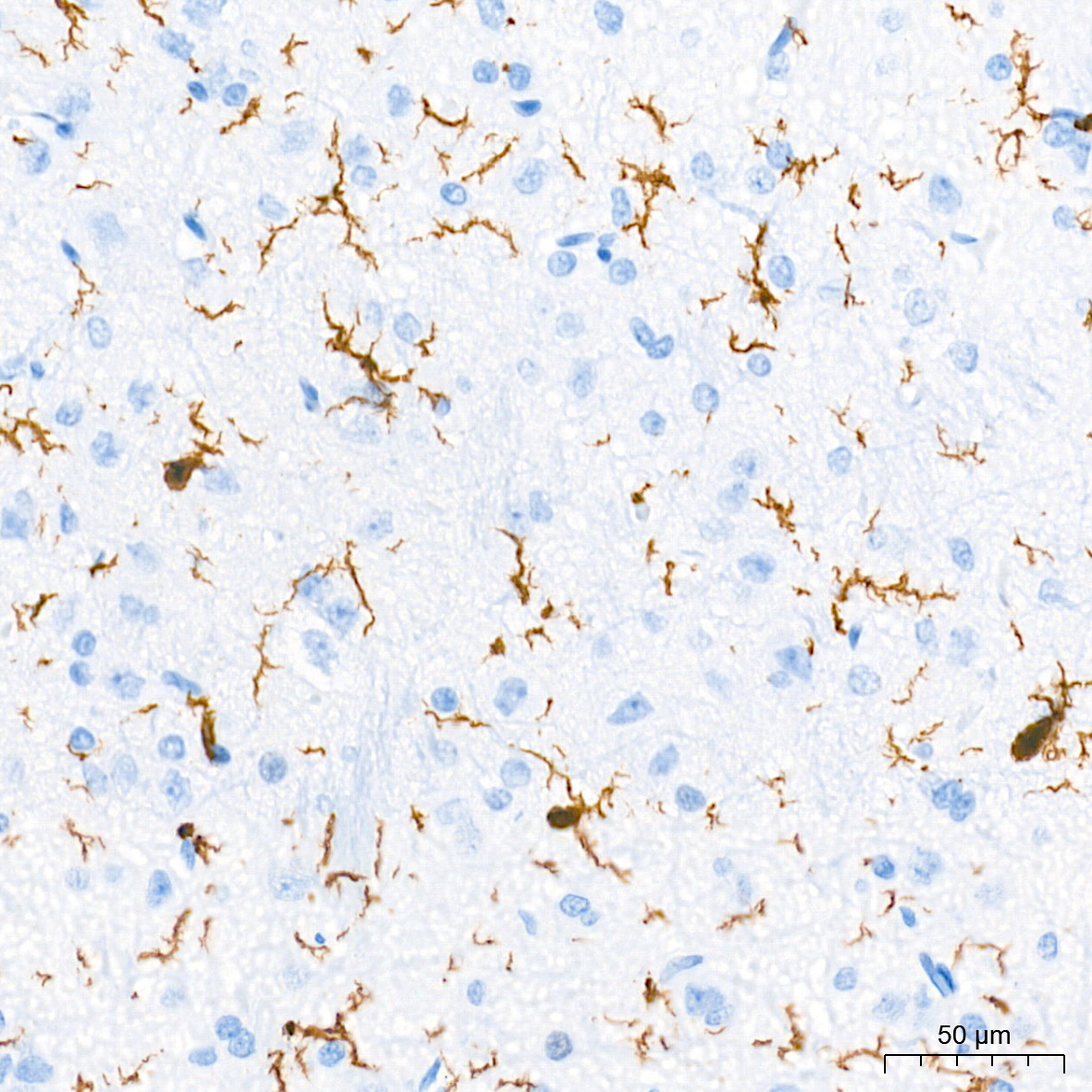 AIF1/IBA1 Rabbit mAb