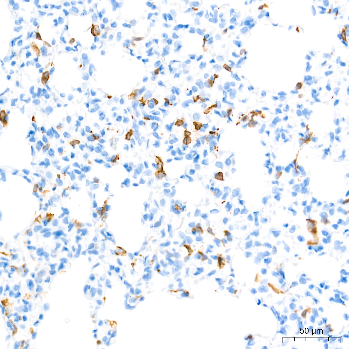 AIF1/IBA1 Rabbit mAb