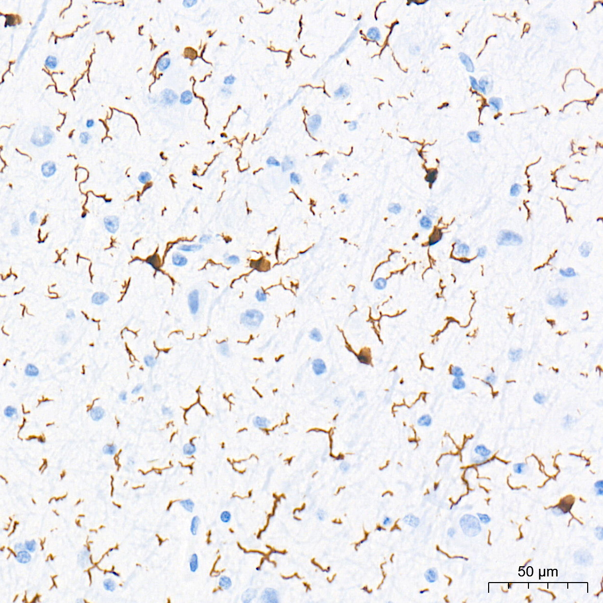 AIF1/IBA1 Rabbit mAb