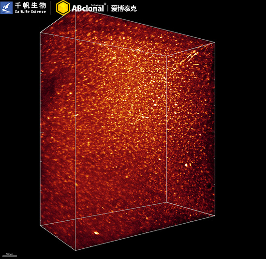 AIF1/IBA1 Rabbit mAb