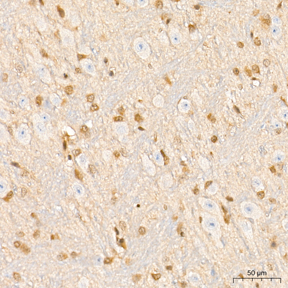 FADD Rabbit mAb