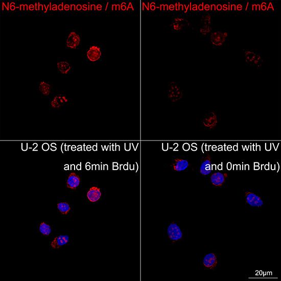 N6-methyladenosine / m6A Rabbit mAb