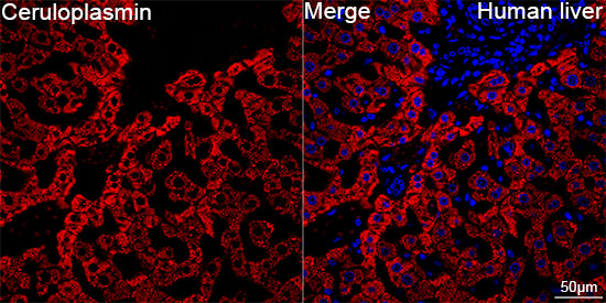 Ceruloplasmin Rabbit mAb