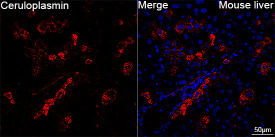 Ceruloplasmin Rabbit mAb