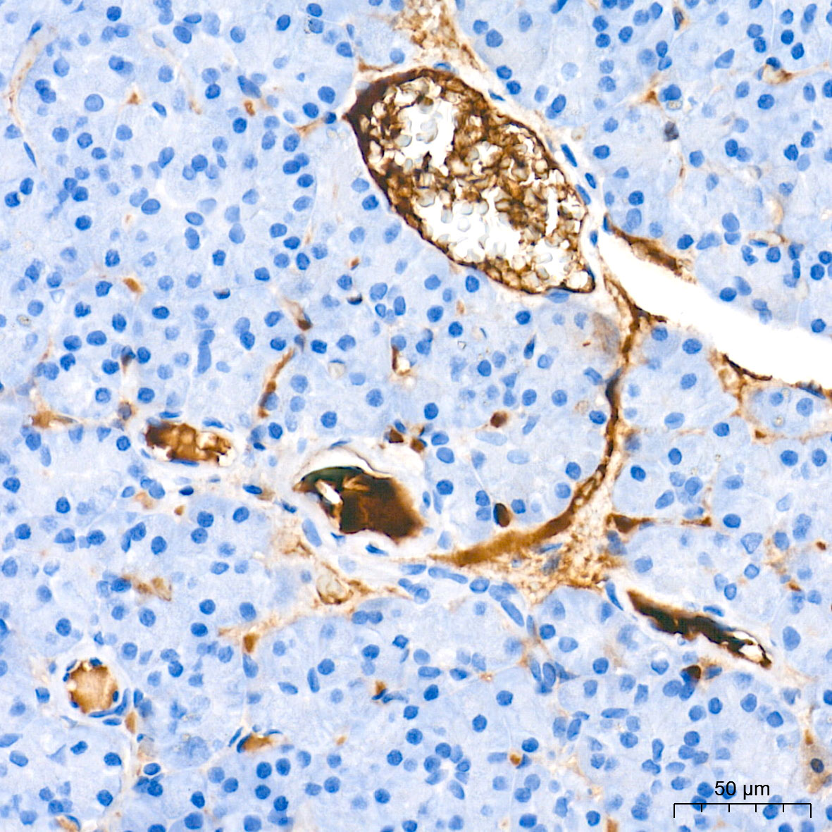 Ceruloplasmin Rabbit mAb