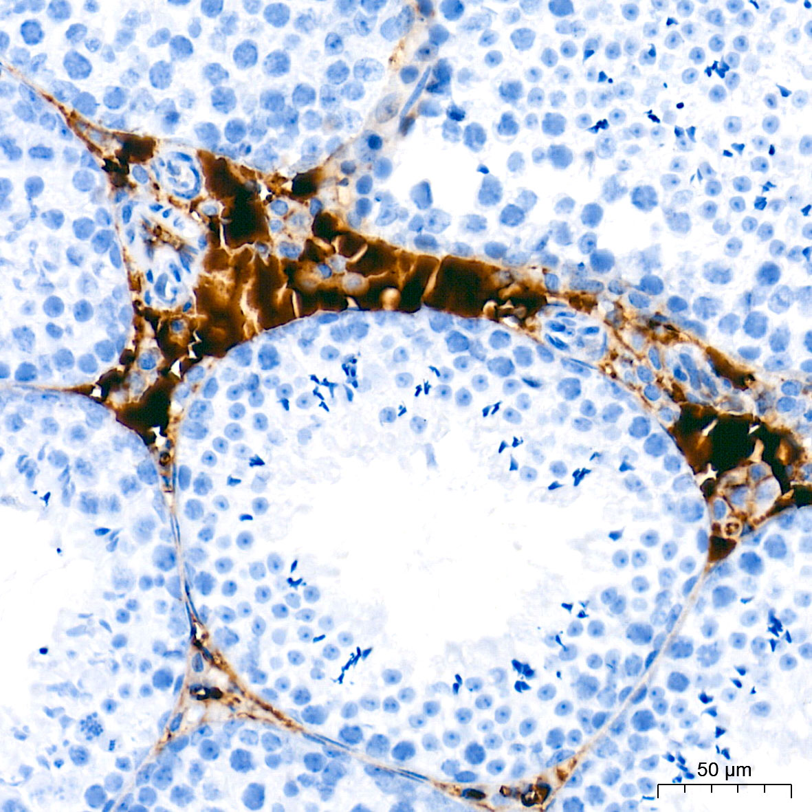 Ceruloplasmin Rabbit mAb