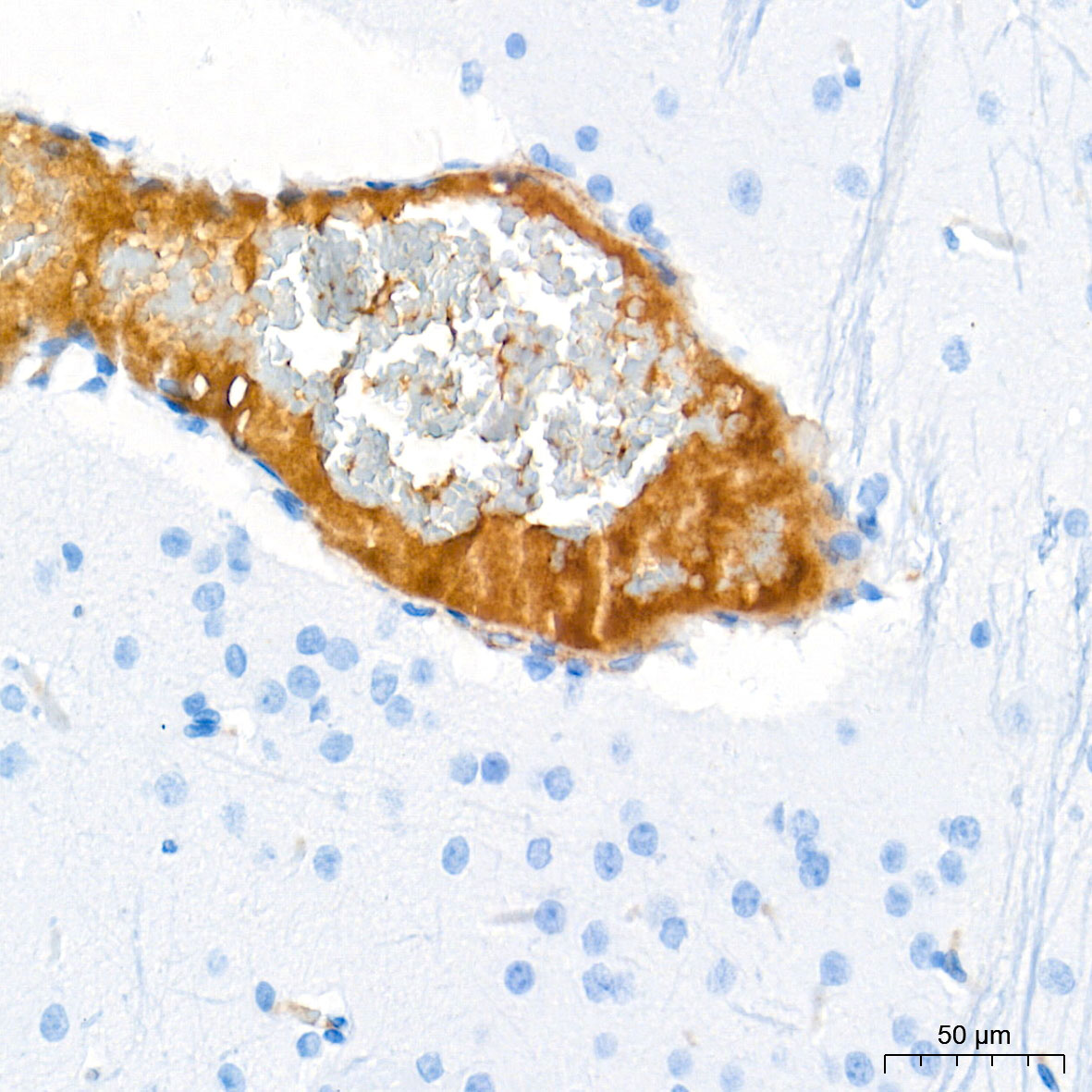 Ceruloplasmin Rabbit mAb