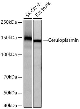 Ceruloplasmin Rabbit mAb