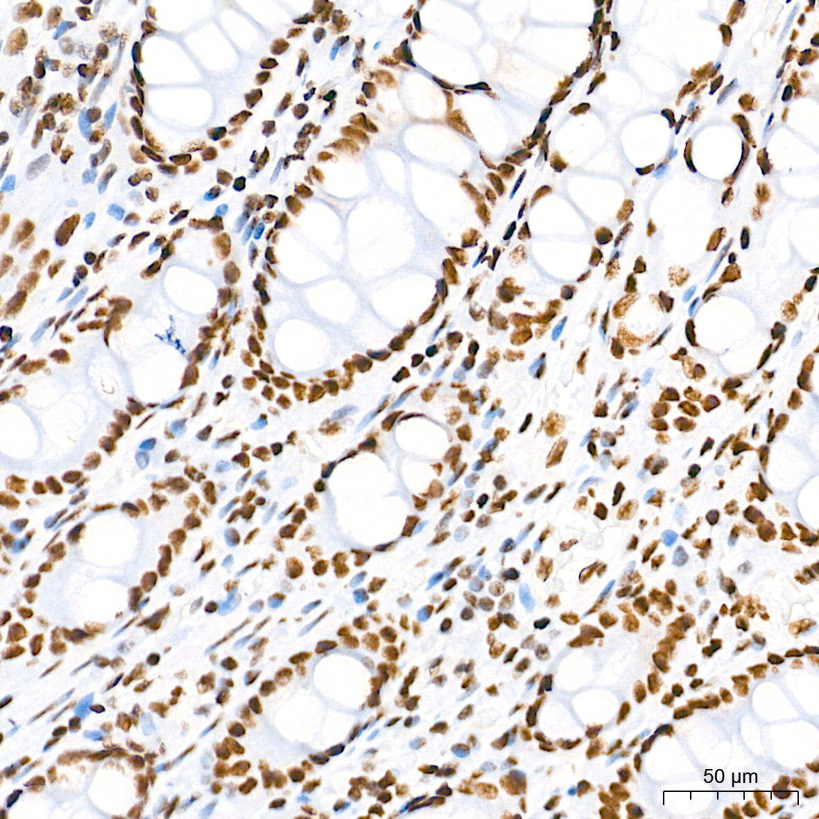 TriMethyl-Histone H3-K36 Rabbit mAb