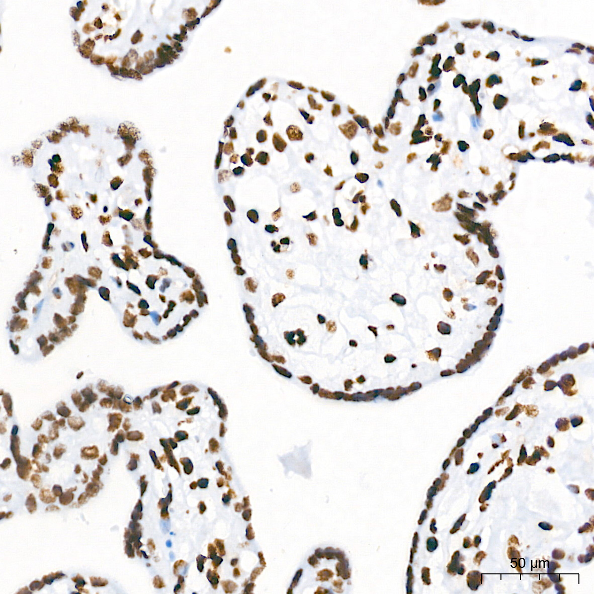 TriMethyl-Histone H3-K36 Rabbit mAb