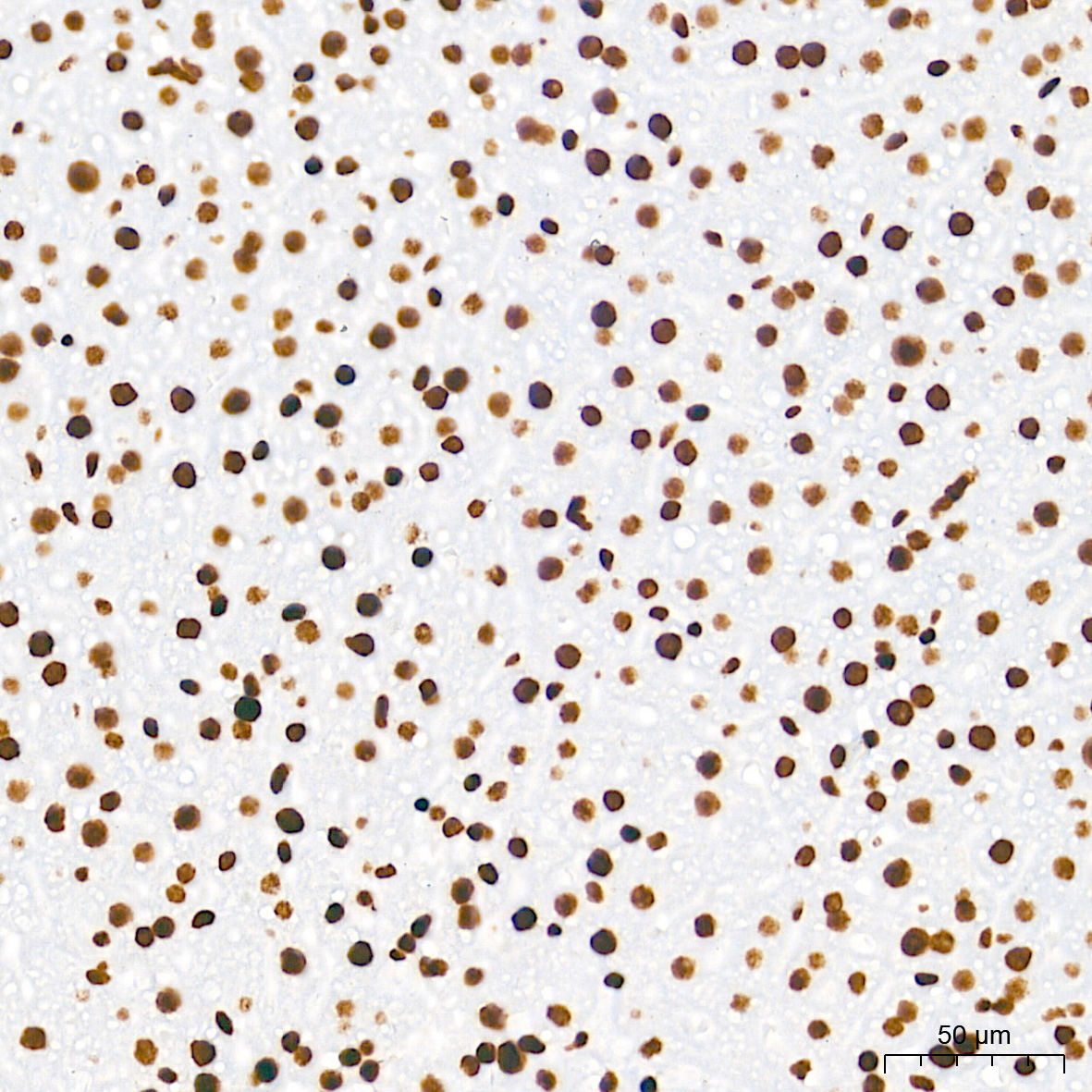 TriMethyl-Histone H3-K36 Rabbit mAb
