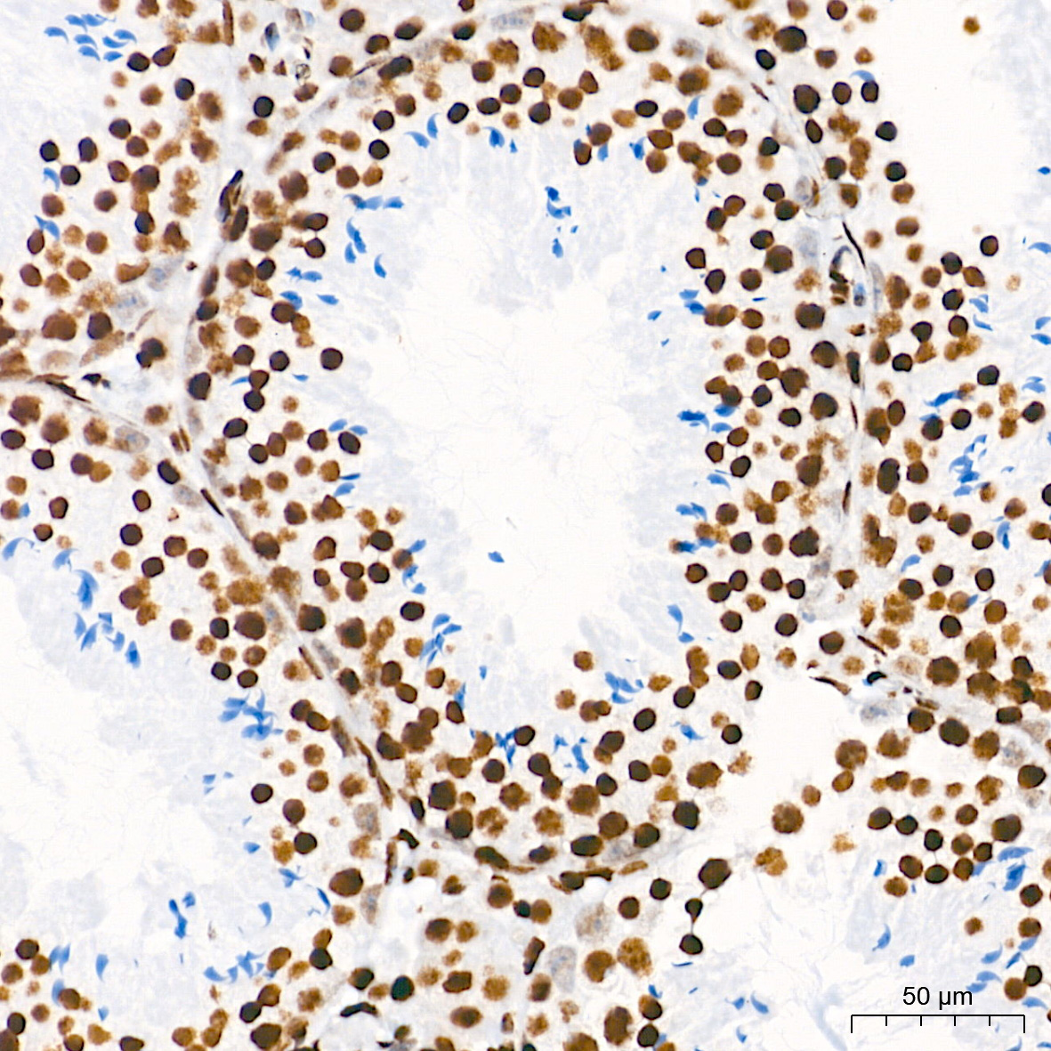 TriMethyl-Histone H3-K36 Rabbit mAb