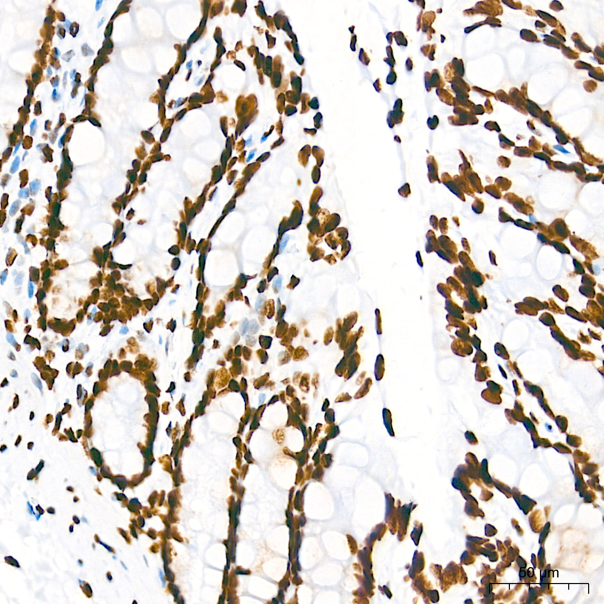 TriMethyl-Histone H3-K36 Rabbit mAb
