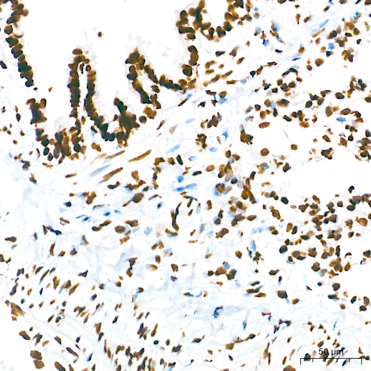 TriMethyl-Histone H3-K36 Rabbit mAb