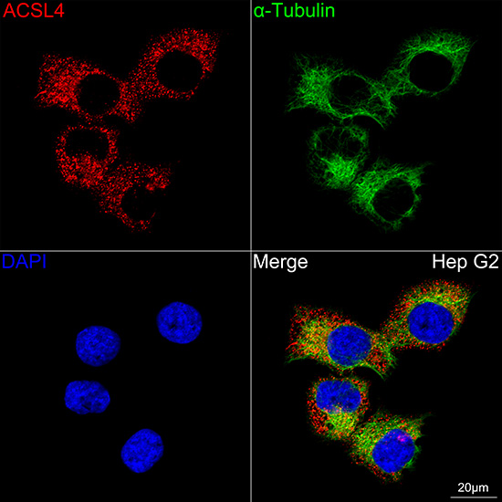 ACSL4 Rabbit mAb