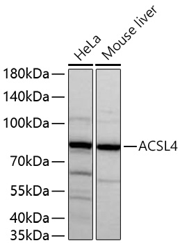 ACSL4 Rabbit mAb